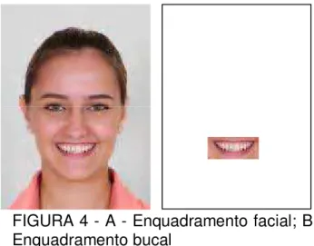 FIGURA 4 - A - Enquadramento facial; B - -Enquadramento bucal