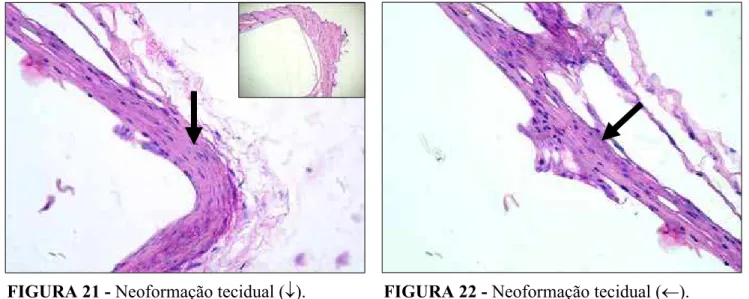 FIGURA 22 - Neoformação tecidual (m). H.E.400XFIGURA 21 - Neoformação tecidual (p).