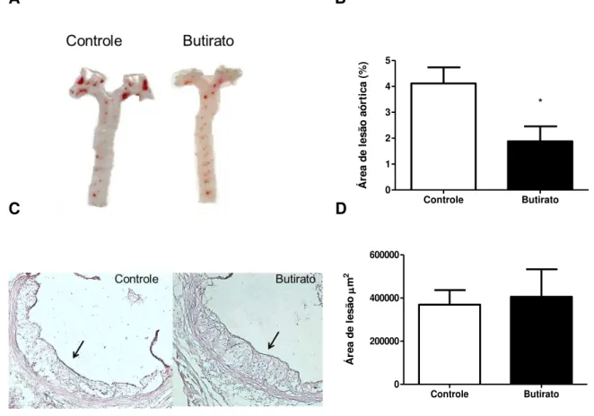 Figura  8-  Desenvolvimento  da  aterosclerose  em  animais  apoE-/-  submetidos  à  dieta  controle  ou  suplementada  com  butirato  de  sódio  por  dez  semanas