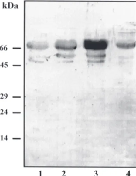 Fig. 4: proteolytic activity  of Leishmania amazonensis fractions.