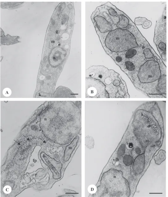 Fig. 3: transmission electron microscopy of Herpetomonas samuelpessoai grown in defined medium at 28 o C