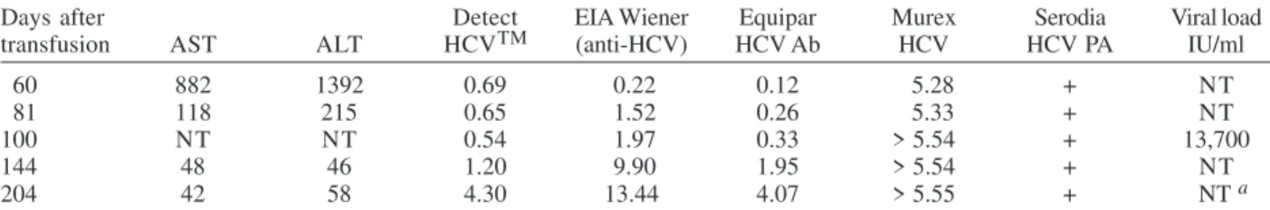 TABLE II