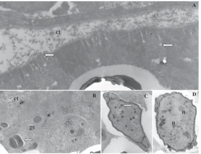 Fig. 2: electron micrographs of Henneguya caudalongula sp. n. from Prochilodus lineatus