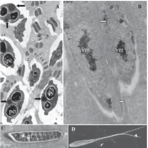 Fig. 3: electron micrographs of spores of  Henneguya caudalongula sp. n. A: transversal sections of mature spores in the polar capsule (pc) level showing the electron-dense spherical inclusions (arrows)
