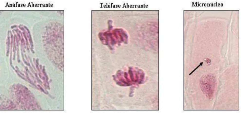 Figura 2: Alterações cromossômicas e micronúcleos em células meristemáticas de raiz  de Allium cepa