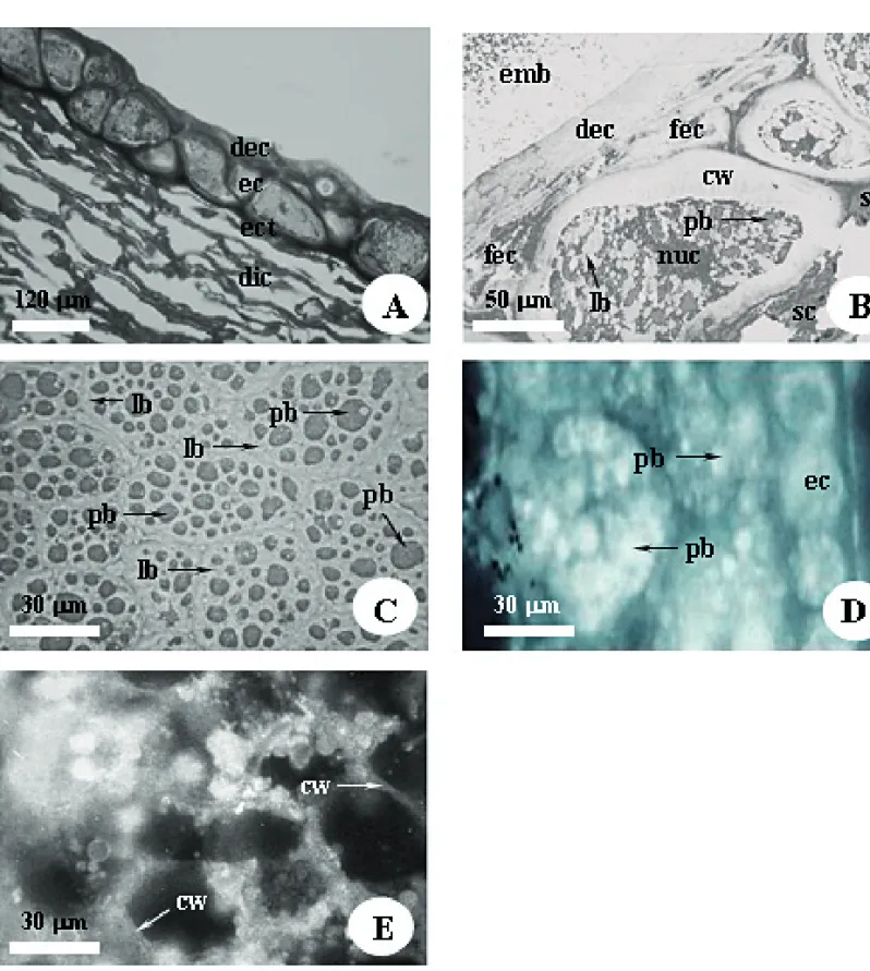 Figure 2. Micrographs of the Centrolobium robustum endosperm and inner integument. Thick cell walls of the endosperm reacted with PAS  (A)