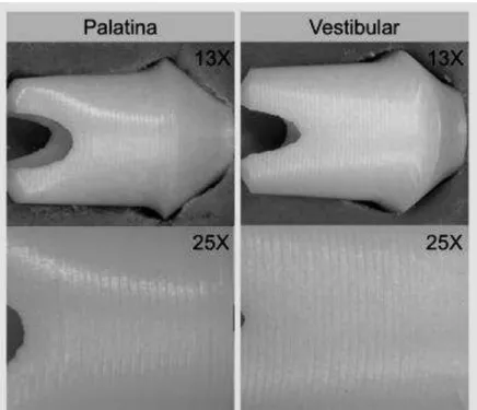 Figura 5 - Imagem dos pilares Nobel Biocare obtidas em estereomicroscopia em  aumento de 13X e 25X