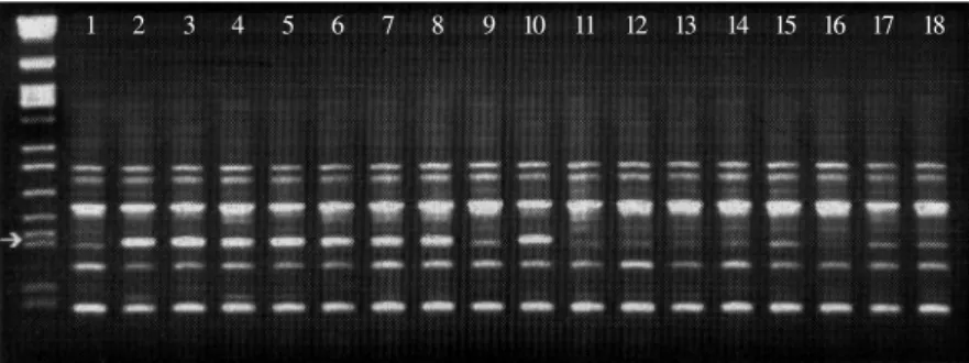 Figure 1 - Electrophoretic analysis of amplification products obtained with primer OPAH1.