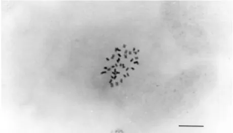 Figure 3 - Mitotic metaphase of a somatic hybrid plant showing 2n = 4x = 36 (Bar = 1 µm).