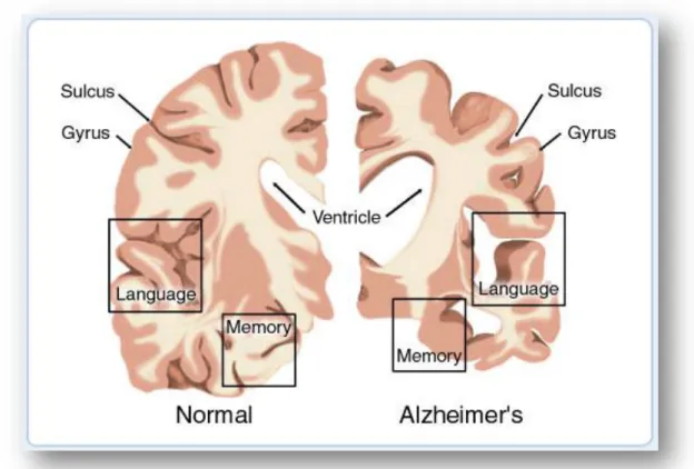 Fig.  1:  This  image  represents  a  cross-section  of  the  brain  as  seen  from  the  front