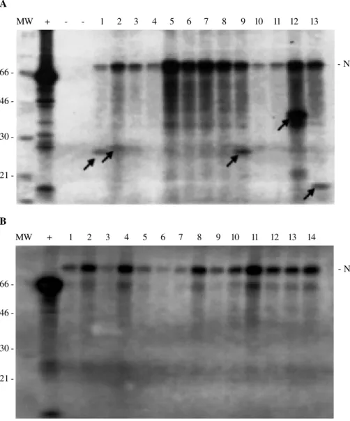 Figure 1 - Two overlapping segments of APC, encompassing codons 686 to 1217 and codons 1099 to 1693, were analyzed in 35 colon adenocarcinomas and 39 gastric adenocarcinomas