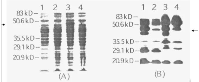 Figure 2 - Expression of ompA-OV7A fusion protein as determined by SDS-PAGE and Western blotting