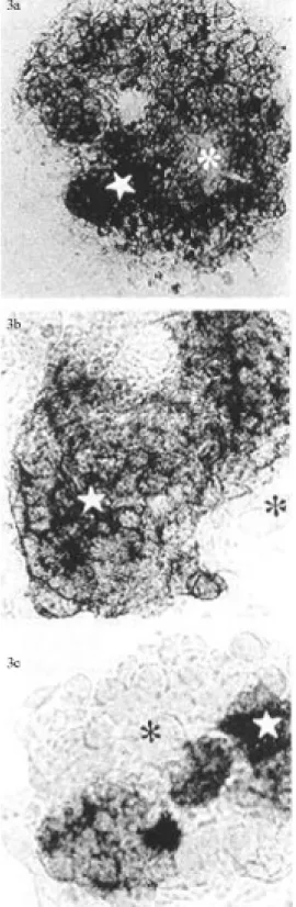 Figure 3 - Localization of AP activity in: HM-1 (3a), HESS-2 (3b) and HESS-1 (3c) cells during cultivation on a feeder layer