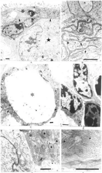 Figure 5 - Electron micrographs showing parts of HM -1 cell derived embryoid bodies (EBs)
