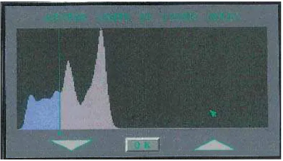 Figura 04   Tela mostrando o gráfico de ajuste  de definição  entre partes moles e a área de  leitura da densidade mineral óssea