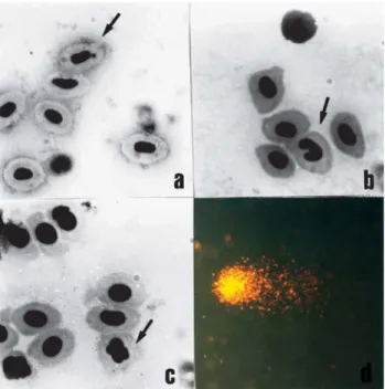 Figure 2 - a) Typical micronucleus, b) and c) morphological nuclear alter- alter-ations, d) comet class 3.
