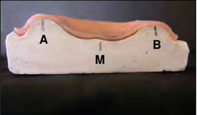 FIGURA 8- Pontos referenciais para leitura da                    desadaptação na porção anterior do                    conjunto seccionado modelo de                    gesso-base de resina