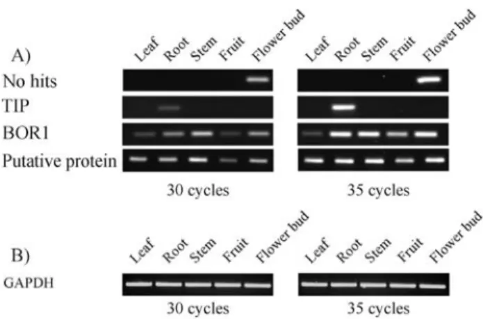 Figure 5 - RT-PCR validation of candidate clusters. RT-PCR was per- per-formed with specific primers using RNA from the organs indicated above each lane and the products were separated in an 1% agarose gel containing ethidium bromide
