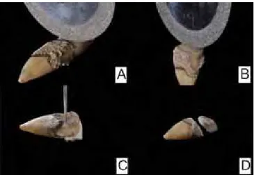 Figure 2 - A) Cutting with diamond disc separating the crown from the ROI. B)  Cut in buccal-lingual orientation