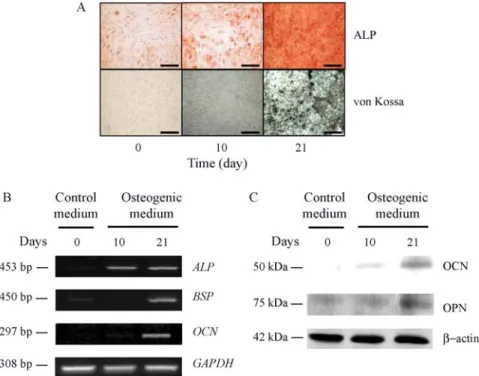 Figure 2 - Osteogenic differentiation of hMSCs. (A) ALP staining and von Kossa staining