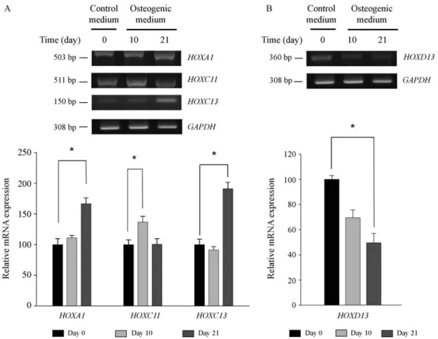 Figure 3 - HOX multiplex PCR. (A) The mRNA expression of HOXA1, HOXC11 and HOXC13 increased during osteogenesis