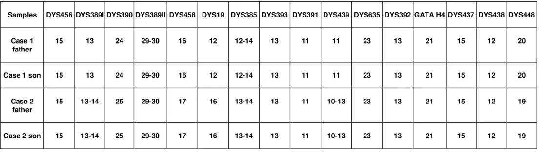 TABLE S2 – Y-STR haplotype profiles showing the presence of additional alleles at DYS389II (case 1) and DYS389I, DYS389II and  DYS439 (case 2), after amplification with the AmpF/STR Yfiler kit