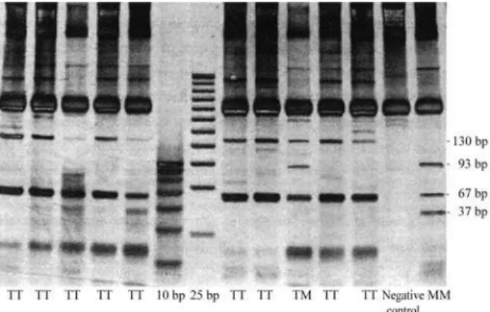 Figure 1 - Polyacrylamide gel electrophoresis showing the T945M muta- muta-tion genotypes analyzed through the PCR/RFLP method.