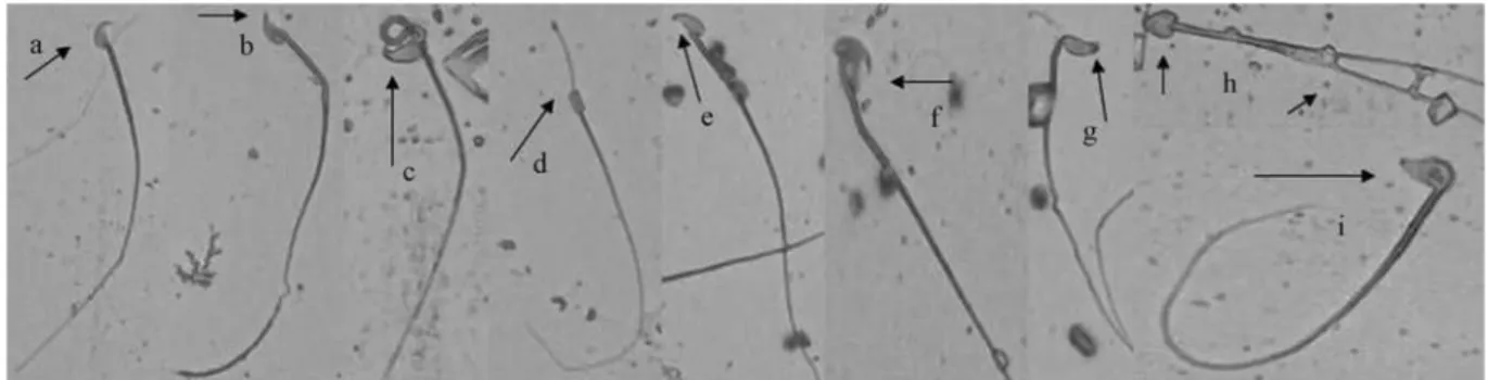 Figure 5 - Abnormal sperm cells induced in mice exposed to different concentrations of the pharmaceutical effluent (a) normal sperm cell, (b) wrong-angled hook, (c) folded sperm, (d) pin head, (e) very short hook, (f) wrong tail attachment, (g) No hook, (h