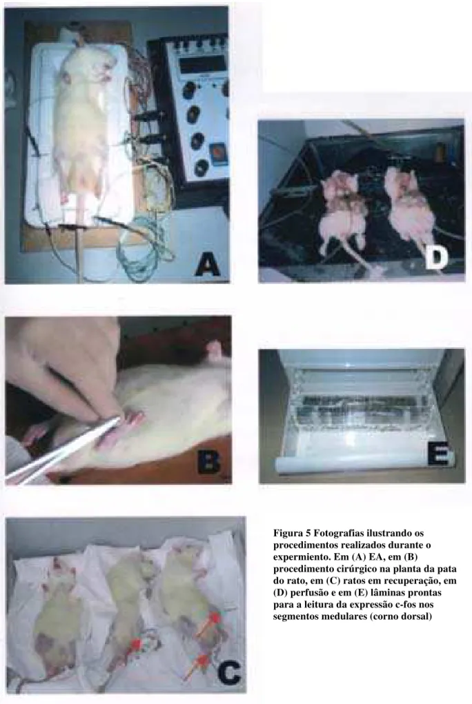 Figura 5 Fotografias ilustrando os  procedimentos realizados durante o  expermiento. Em (A) EA, em (B) 
