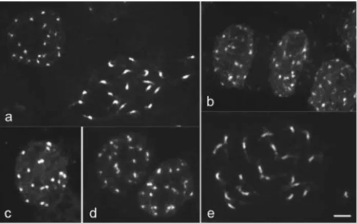 Figure 2 - Interphase and prophase cells of cacao (a, c) and cupuaçu (b, d, e) stained with DAPI before (a, b) and after C-banding (c, d, e)