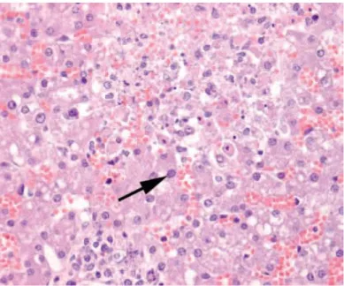 Figura 9. Presença de um corpo de inclusão num hepatócito,  que pode ocorrer em infeções por herpesvirus canino (Adaptado  de Rootwelt, 2011)