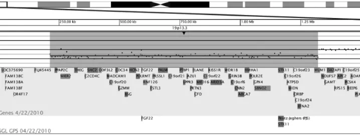 Figure 2 - Deletion at 19p13.3. Array-CGH analysis showed a single-copy loss of 84 oligonucleotide probes at 19p13.3, approximately 1.1 Mb in size (chr19:213,080-1,322,552, UCSC March 2006 hg18 assembly)