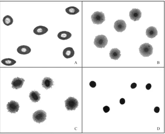 Figure 2 - DNA diffusion assay images from E. johnstonei blood cells after: (A) alkaline lysis, (B) alkaline/enzymatic (40 mg/mL proteinase K) lysis at 37 °C overnight, (C) enzymatic (40 mg/mL proteinase K) lysis at 37 °C overnight, and (D) enzymatic (40 m