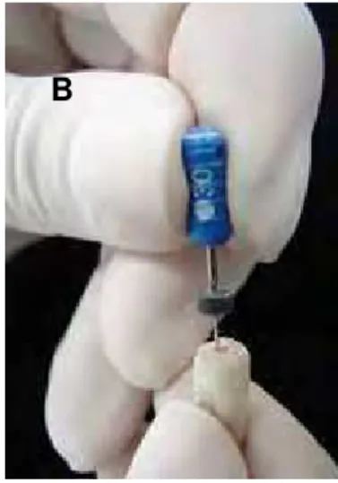 FIGURA 4 – (A) Colocação de eucaliptol; (B) Desobturação manual com  lima Hedströem. 