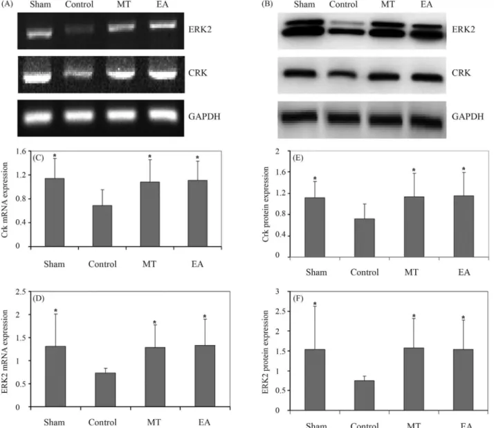 Figure 5 - Effect of EA on Crk and ERK2 expression in AF cells. (A), (C) and (D) Crk and ERK2 mRNA levels of in the four groups were determined by RT-PCR