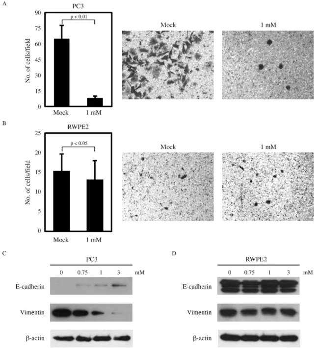 Figure 2 - Effects of VPA on the invasiveness of prostate cells. Matrigel invasion assays for PC3 (A) and RWPE2 (B) cells