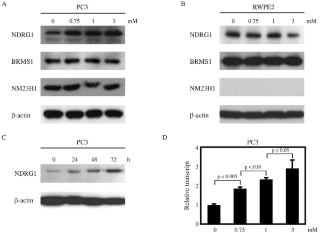 Figure 3 - VPA increases NDRG1 expression in PC3 cells. 24 h after seeding, cells were treated with VPA