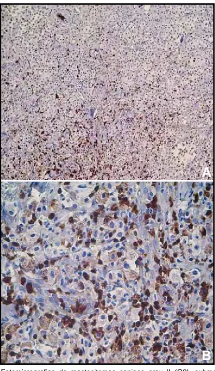 Figura 10 - Fotomicrografias de mastocitomas caninos grau II (G2), submetidos à  reação de imunoistoquímica pelo método ABC, ilustrando grande número  de macrófagos associados ao tumor