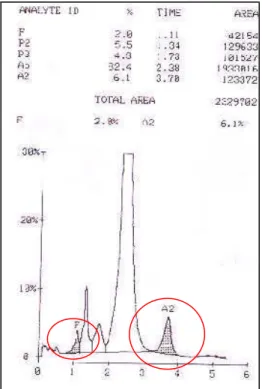Figura 19: Cromatograma  de um indivíduo portador de talassemia beta, onde pode  ser observados os picos de Hb F e Hb A 2  (Fonte: LHGDH)