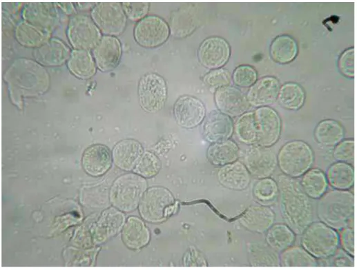 Figura 9: Fase do Ciclo Estral: Proestro. Predominância de células epiteliais nucleadas no esfregaço  (aumento 40x).