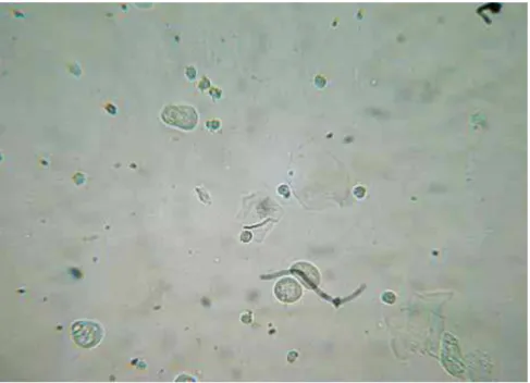 Figura 11: Fase do Ciclo Estral:  Metaestro. O esfregaço é composto células epiteliais, células  cornificadas e leucócitos  na mesma proporção (aumento 40x)
