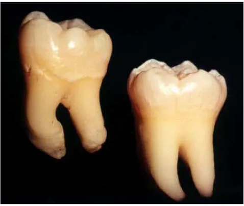 FIGURA 1  – Dentes molares permanentes hígidos de humanos, utilizados na  pesquisa