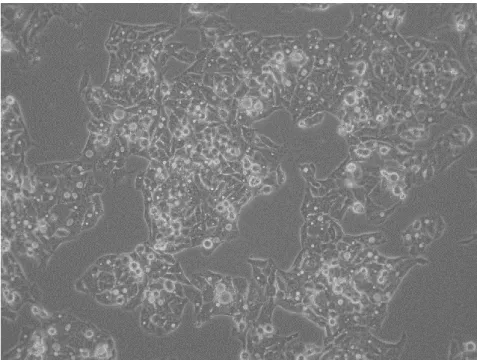 Figure    1.4  Representative  image  of  Human  hepatoma  cells  (HepG2).  Image  acquired  using  a  inverted  phase  contrast  microscope  (Olympus,  Japan)  Magnification: 100x magnification