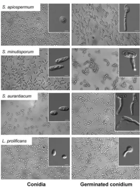 Fig. 5: light microscopies showing the dormant (0 h-conidia) and germi- germi-nated conidial cells of Scedosporium apiospermum, S