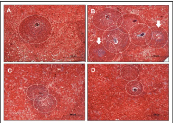 Fig. 2: histomorphometric study of liver tissue. Analysis of hepatic  granulomas in Swiss Webster mice born and suckled from uninfected  mothers (control) (A), born from infected mothers (B), suckled by  in-fected mothers (C), and born and suckled by schis