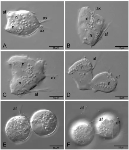 Fig. 5: effect of iron depletion on the division process of Trichomonas vaginalis. Differential interference contrast microscopy (DIC) of   T