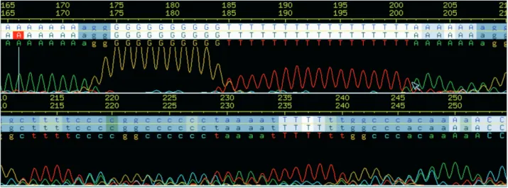 Figure 3 - Consed (www.phrap.org) trace window of a slipped read. The background of the base letters indicates their phred quality