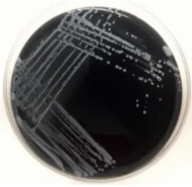 Figure  4  –  Culture  of  Lp  in  BCYE-α  agar  with  4  days  of  incubation  (photo  obtained  in  the  present  study)
