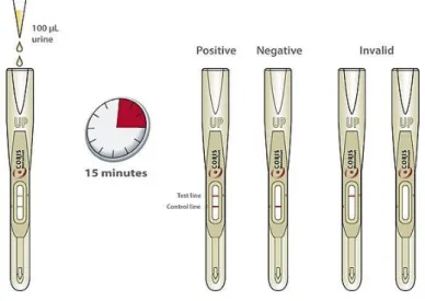 Figure 5 – Rapid diagnostic test for detection of Lp antigen in urine. 