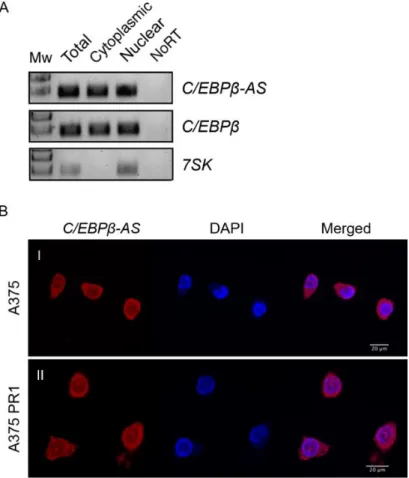 Figure 3.1. Subcellular localization of C/EBPβ-AS and C/EBPβ transcripts in cutaneous melanoma cell lines.